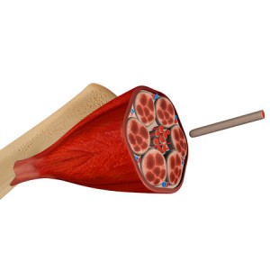 33608071 - muscle tissue