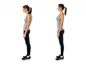38755494 - woman with impaired posture position defect scoliosis and ideal bearing.